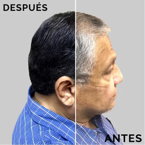 Shampoo Dexe — comparación antes y después canas