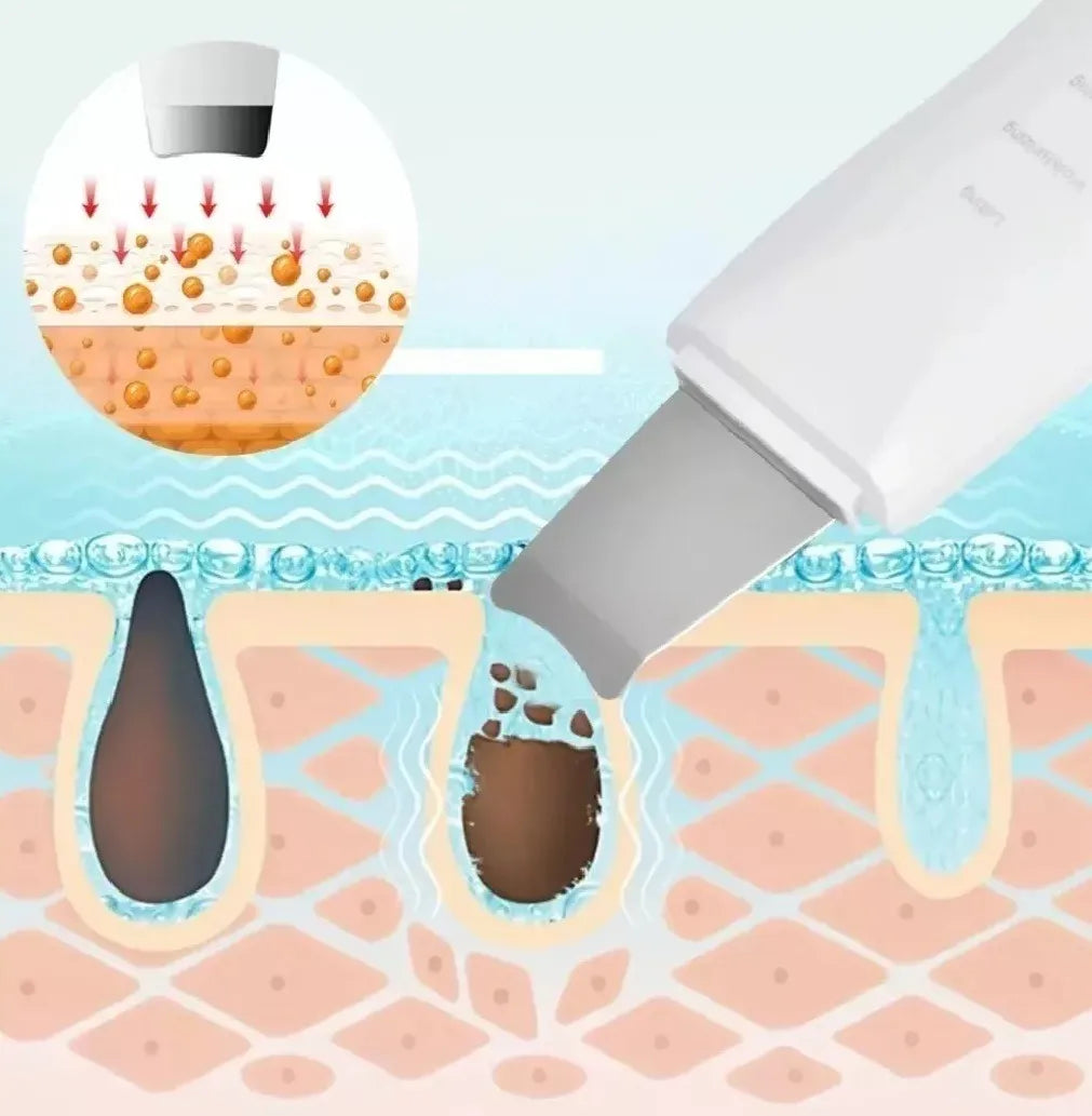 Paleta Ultrasónica Limpiador Facial